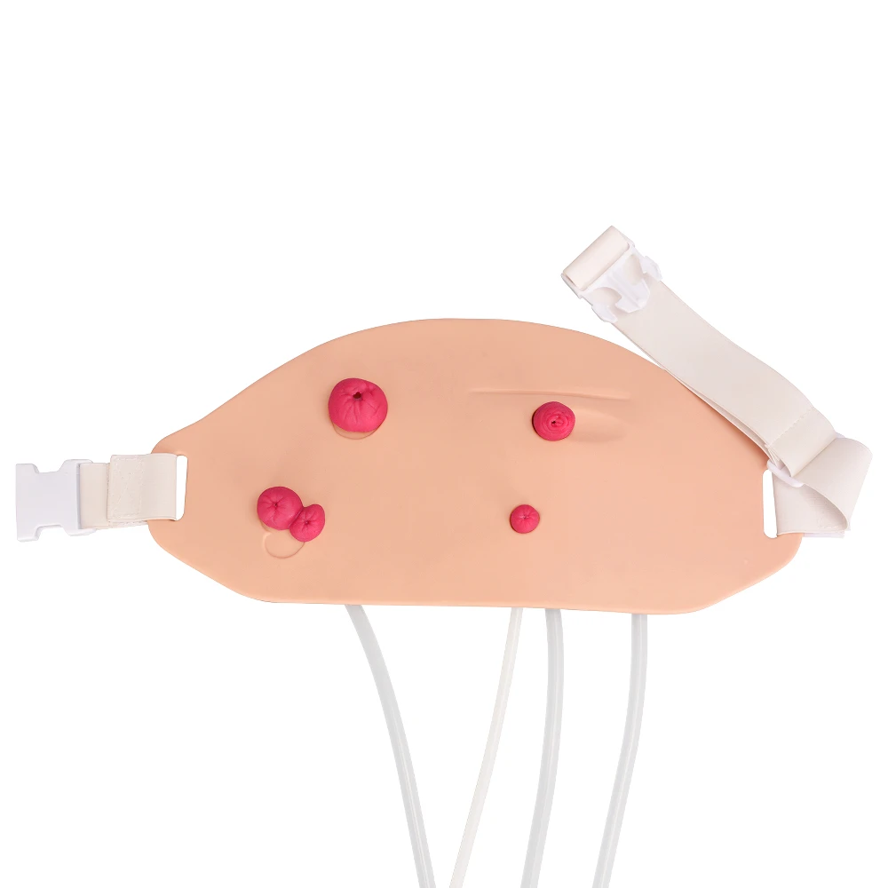 

Wearable Ostomy Stoma Simulator Set, Multi-Skin Tone, Silicon Model