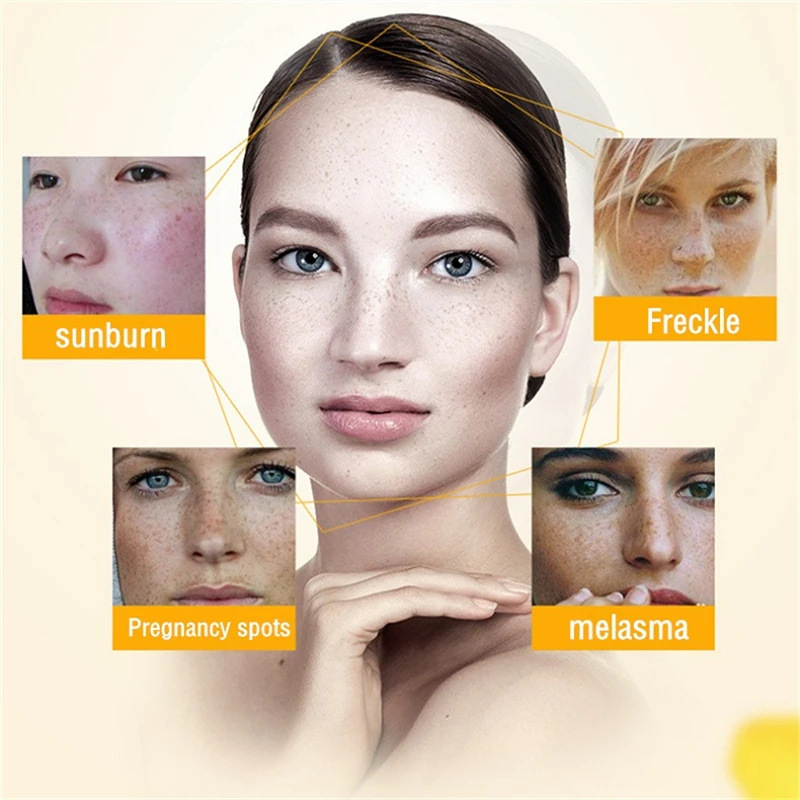 5PCS Niacinamide Whitening Freckle Cream Remove Dark Spots Anti Aging Cream Fade Pigmentation Melasma Brighten Serum Skin Care