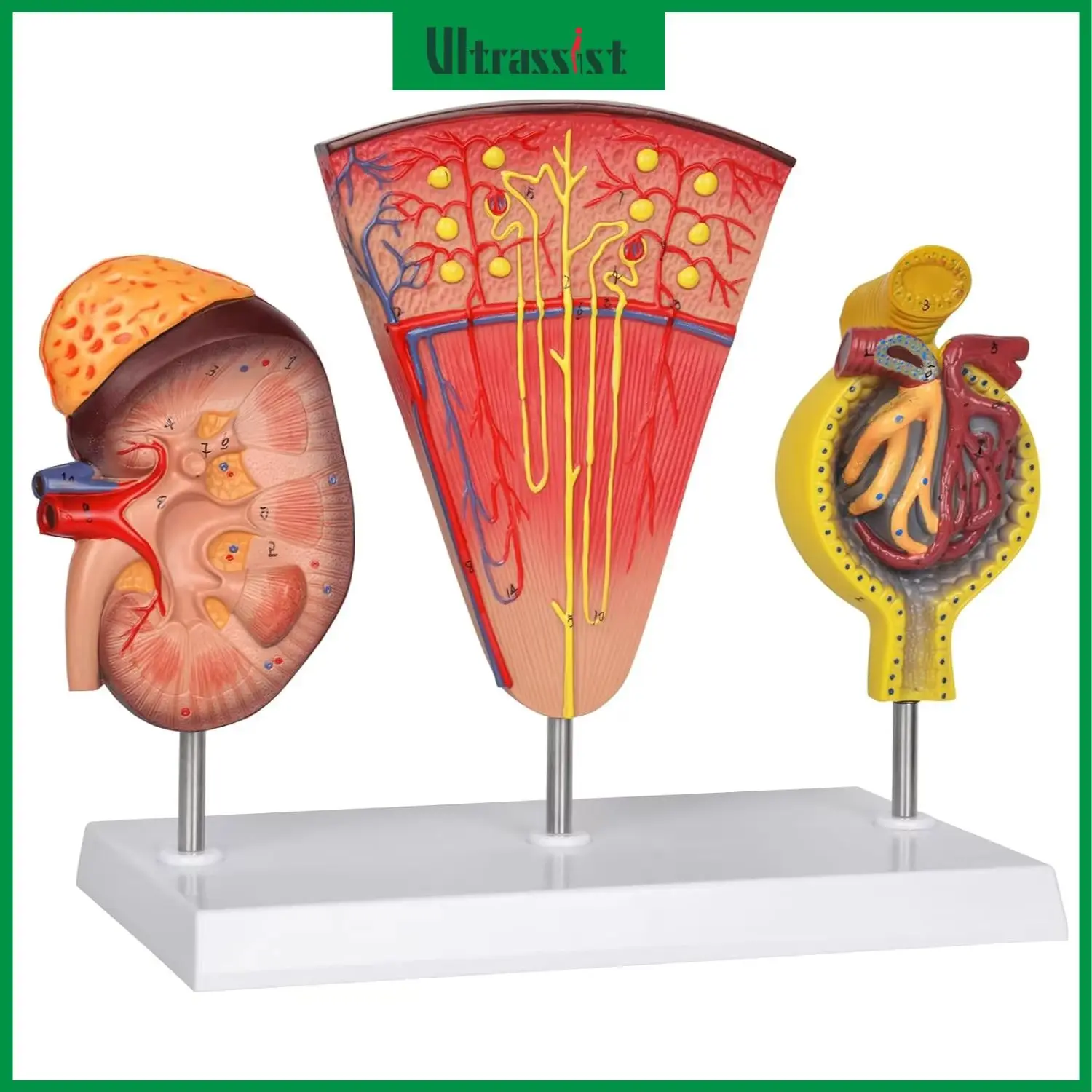 

Ultrassist Anatomical Kidney Model Human Nephron and Glomerulus Model Assisted Dissection for Medical Students Education Class