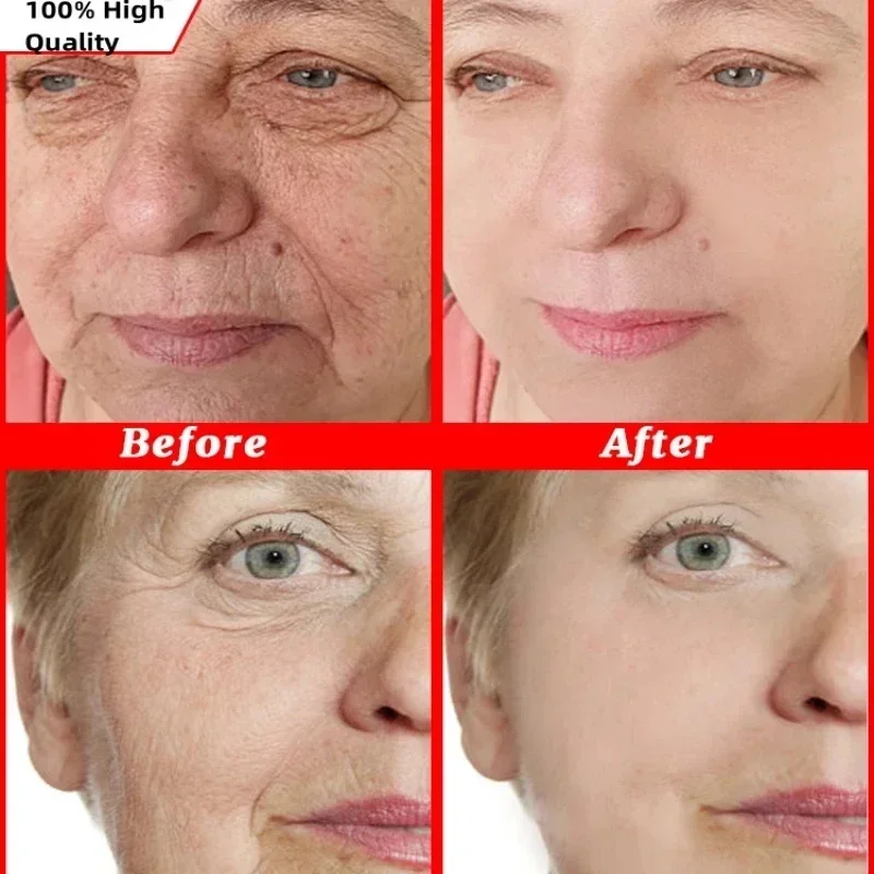 مزيل التجاعيد الفوري كريم وجه مكافحة الشيخوخة ثبات رفع تتلاشى الخطوط الدقيقة تبييض ترطيب سطع تشديد العناية بالبشرة #2