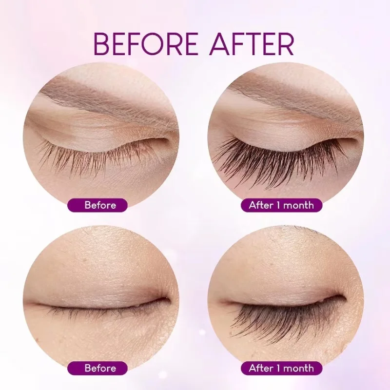 2024 Hot Selling Wholesale Prijs Korea Super Lash Volume Wimper Enhancer Serum Voor Wimpers Wenkbrauwen