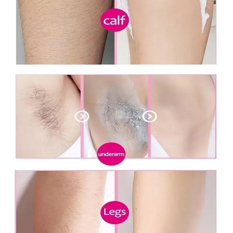 Spray de depilación rápida de 20ml, inhibidor del crecimiento del vello sin dolor, depilatorio permanente para piernas, brazos y axilas, cuidado reparador para mujeres y hombres.