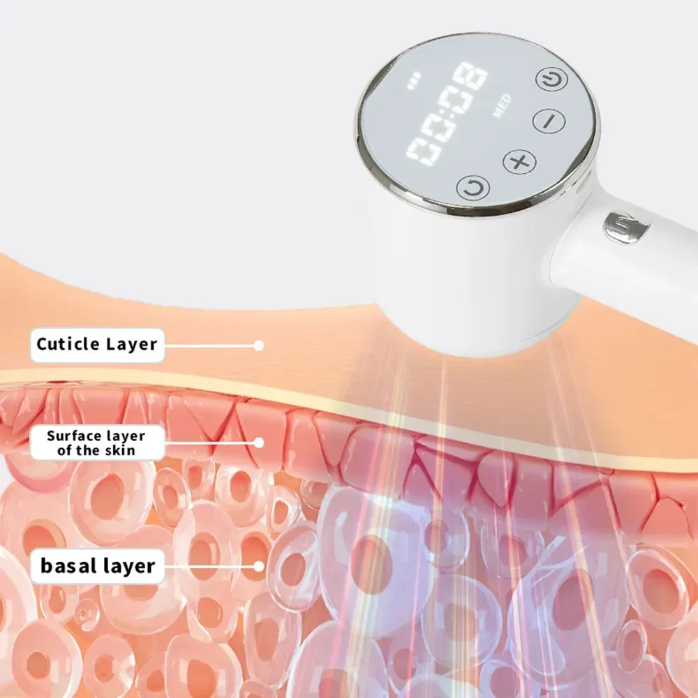 308nm UVB Ultraviolet Fototherapie Lamp Instrument voor Vitiligo Psoriasis Witte Vlek Huidbehandeling en Therapie Behandeling Licht