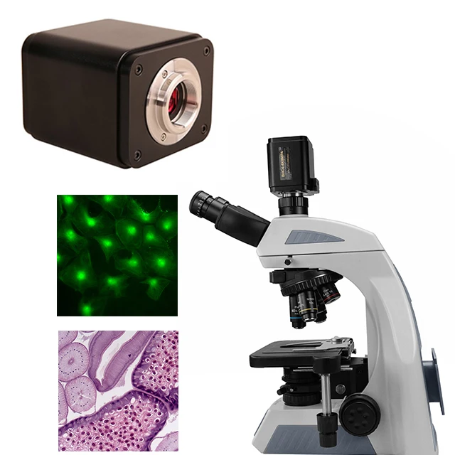 

BestScope BWHC4-4K8MPA 8MP Multi-outputs C-mount 60FPS High Definition Camera For Ophthalmic Surgical Microscope