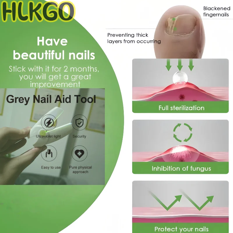 

Устройство для лечения грибка ногтей 2-в-1, лазерная лампа для очистки и фототерапии, портативная с зарядкой типа C