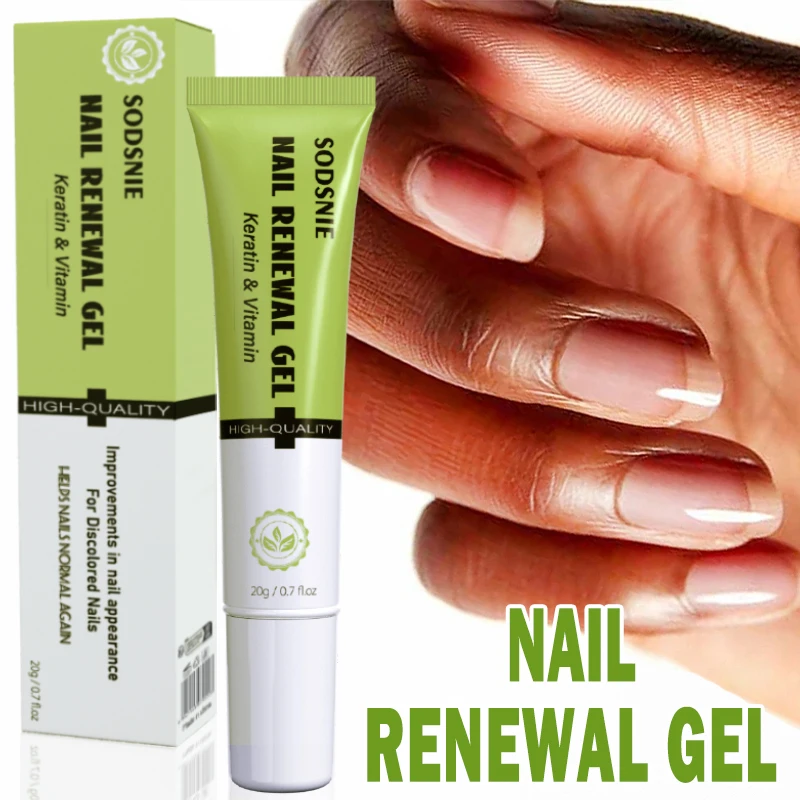 

Intense Nail Strengthening Gel With Vitamin E And Keratin Nail Growth Help Nail Update Nail Repair Hand Foot Nail Care 20g