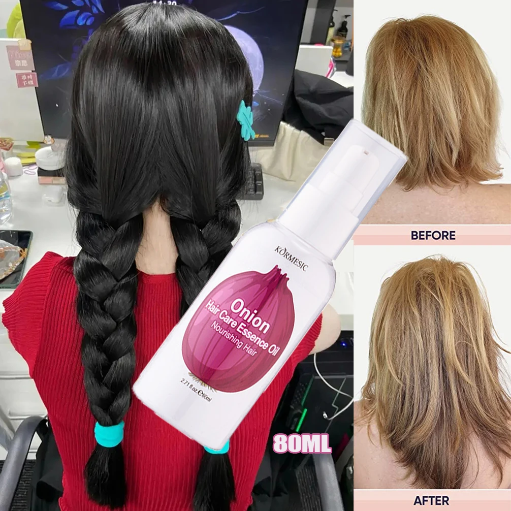 

Onion Hair Growth Essential Oil Hair Care Spray Repair Hairs Damage Prevent Hair Loss Promotes Hair Growth Nourish Hair Roots