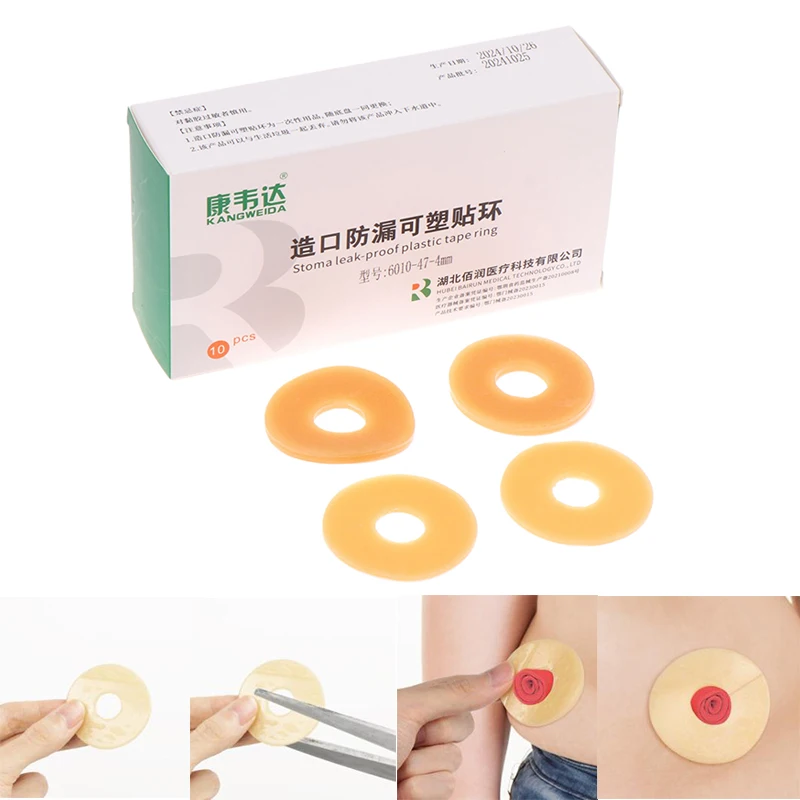 10Pc Anti-Leakage Ring For Colostomy Bag Ostomy Paste Ring Baseplates Stoma Care Products To Protect Skin