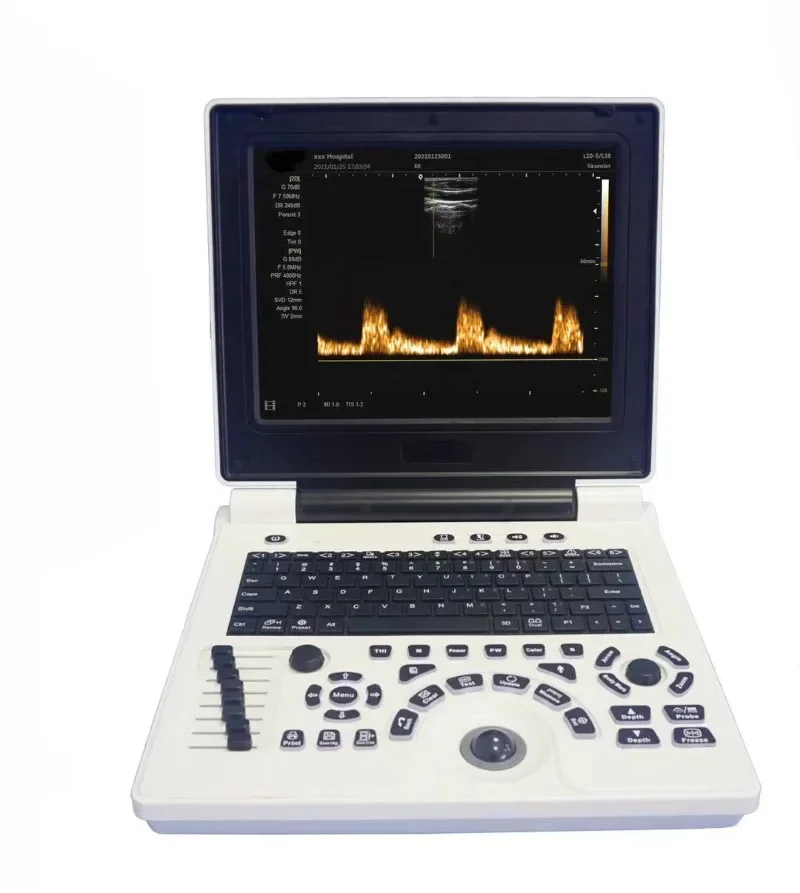 

12 Inch Portable Black White with Micro convex probe Direct factory sales XF P20 Ultrasound Scanner Veterinary Machine Laptop