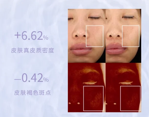 Micro-courant thérapeutique inductif pour les yeux, améliore la relaxation du visage, livraison gratuite