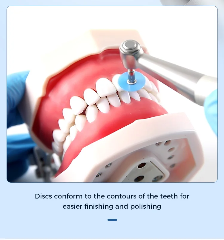 40 Stück/Box AZDENT Dental-Polierscheiben 12mm Polierer Doppelseitig Aluminiumoxid mit Dorn CA2.35mm Zahnarztwerkzeug – Detail 12