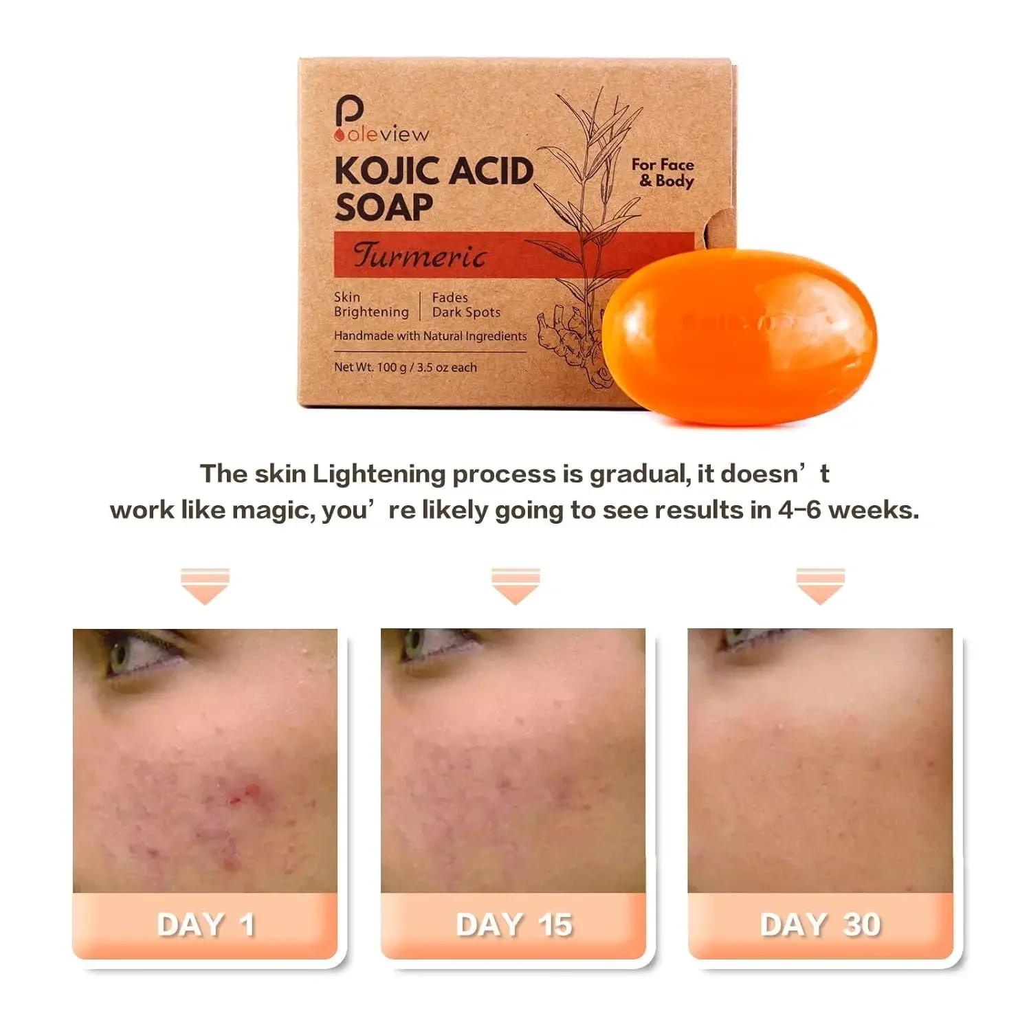 صابون كوجيك حمض الزنجبيل الكركم المصنوع يدويًا لتبييض البشرة وتنظيفها العناية بالحمام الطازج وغير الدهني #6