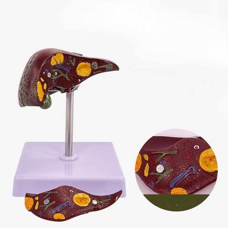 

Human Liver Pathological Anatomical Model Anatomy School Medical Teaching Display Tool Lab Equipment Medical props model