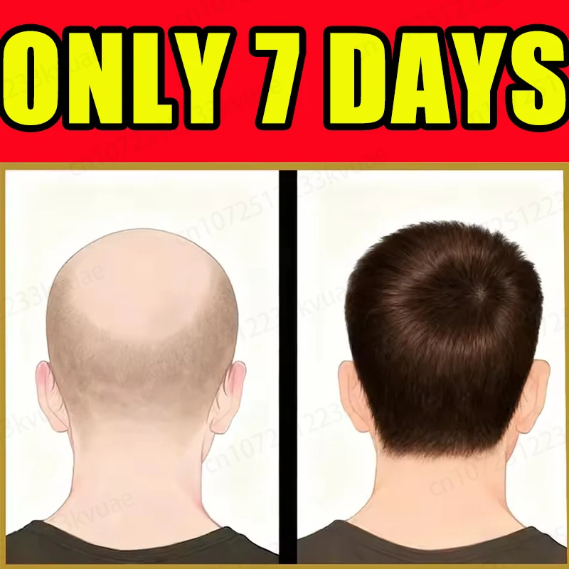 

Сприят кровообращения кожи головы, массаж эфирного масла ускоряет ростовой цикл новых волос.