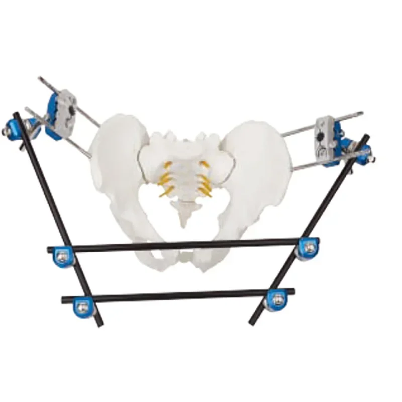 Fijador de medio anillo para implante ortopédico