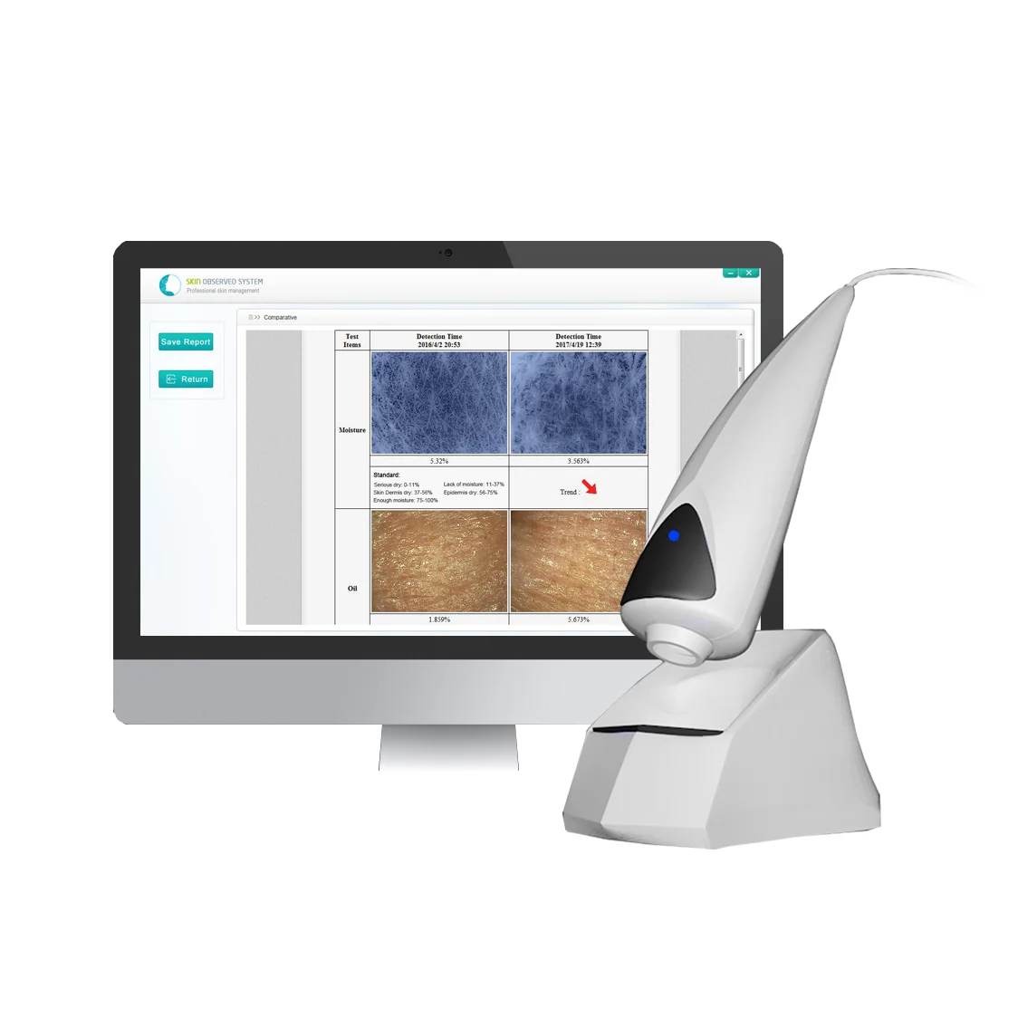 

Observation System Portable Skin Analyzer System with Product Recommendations and Reports