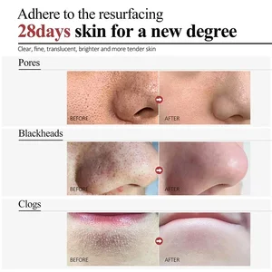 9 en çok satılan ürünler, hidroklorik asit-no. 1