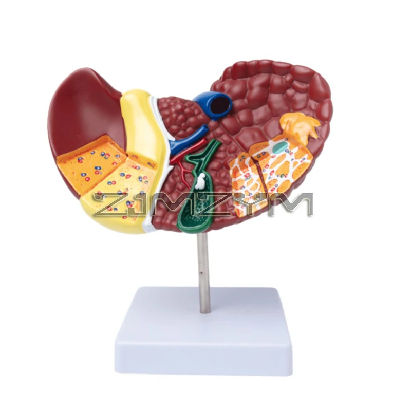 Pathological Liver Anatomical Model 1:1 Human Liver Model Anatomy Display for Medical School Study and Research