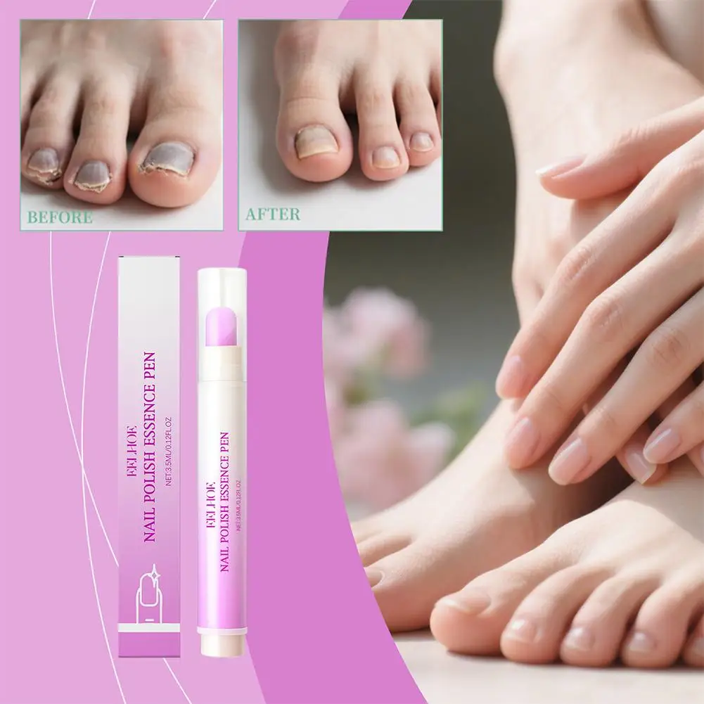 Stylo à Essence de vernis à ongles, adoucit l'élimination des peaux mortes, hydratant, nourrissant, armure de bord, renforce l'armure de levage, soins portables des ongles