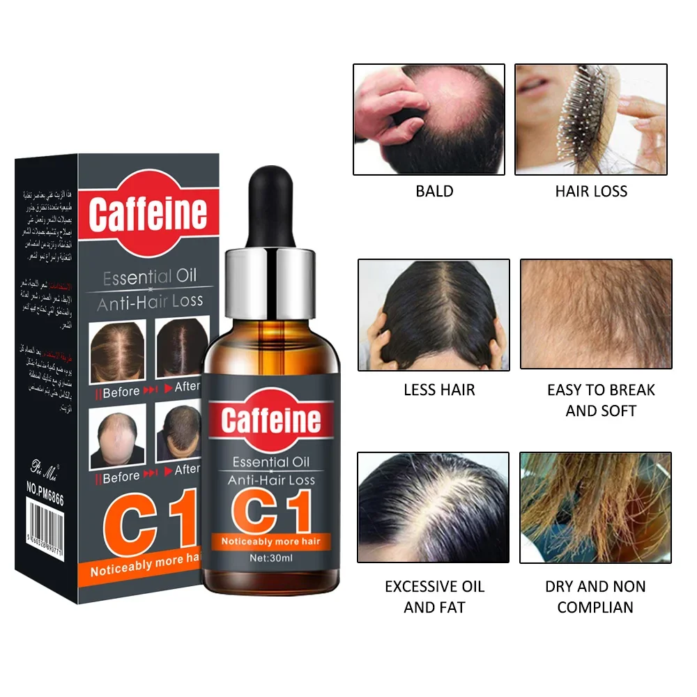 O tratamento do óleo essencial do crescimento do cabelo, crescimento rápido do cabelo, crescimento do cabelo, vitamina E, crescimento do cabelo, eficaz, impede a perda