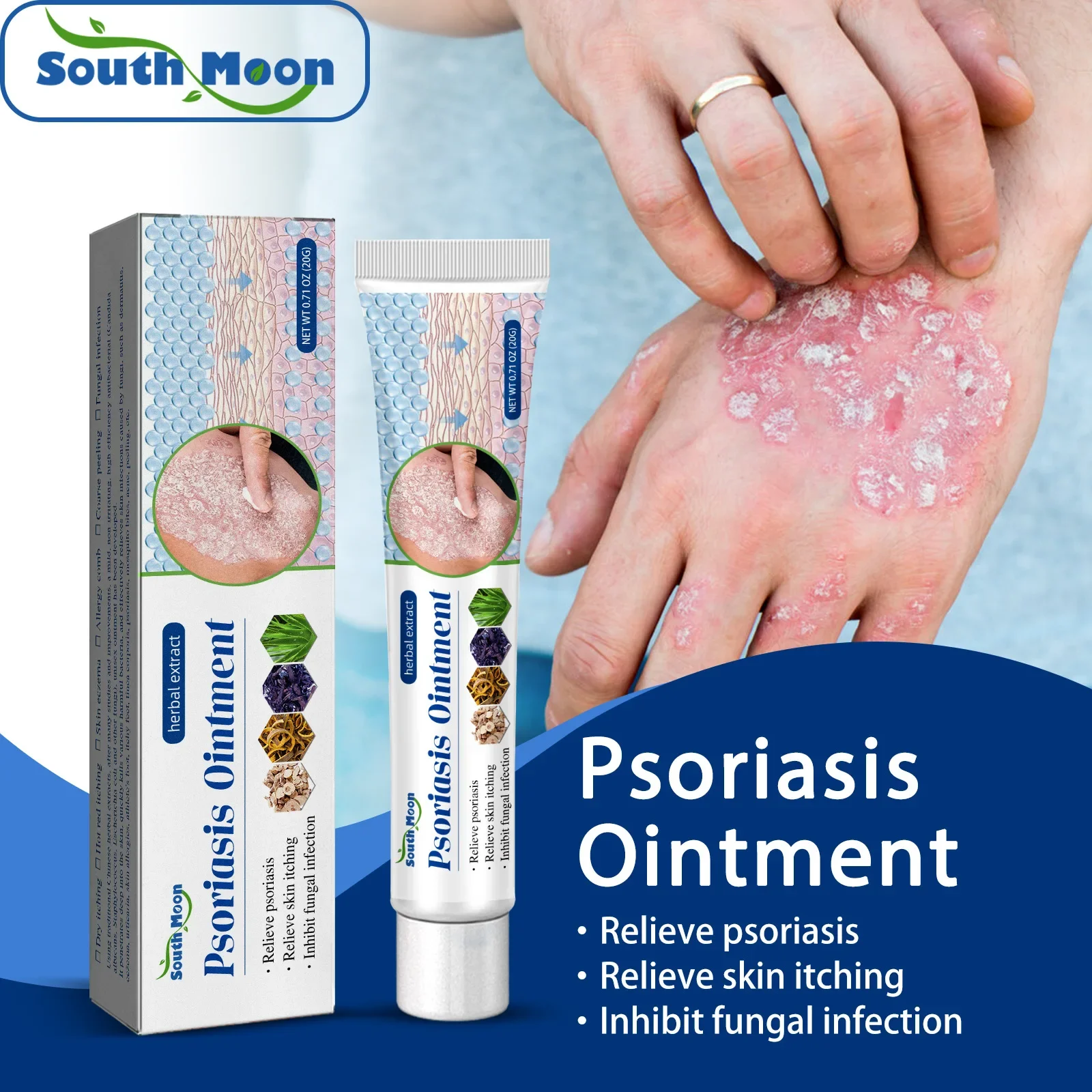 Psoriasis Removal Ointment Psoriasis Eczema Best Anti Psoriasis Dermatitis Products Natural Plant Extracts