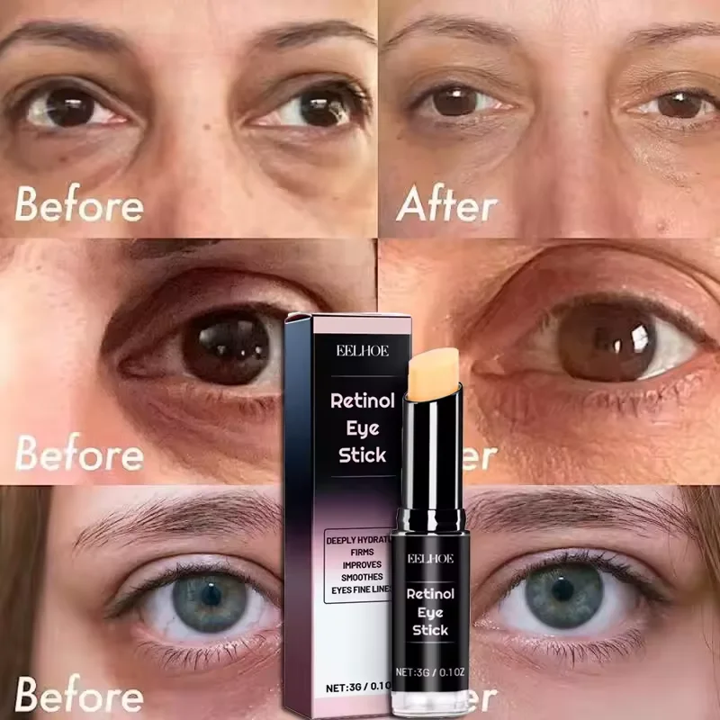 Retinol Anti-wrinkle Eye Cream Stick Anti Puffiness Remove Dark Circles Eye Bags Fade Fine Lines Moisturizing Brighten Eye Care