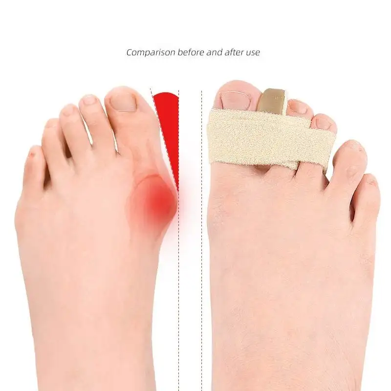 1/2Pc Silicone Gel Thumb Corrector Bunion Foot Toe Hallux Valgus Protector Separator Finger Straightener Adjuster Foot Care Tool