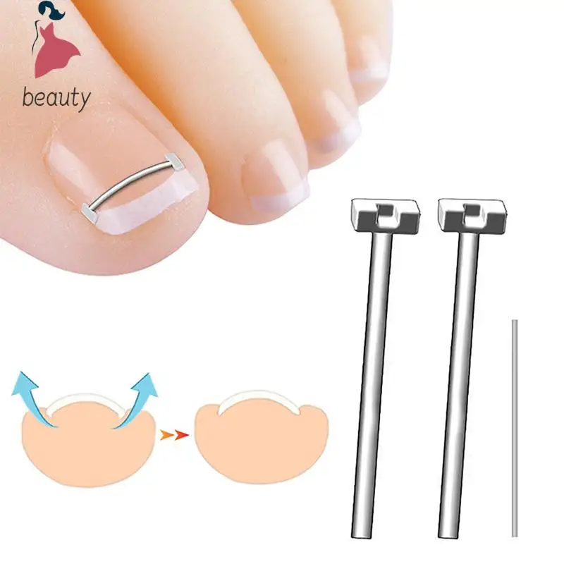 Corrector de uñas encarnadas, herramienta de pedicura, tratamiento profesional de uñas encarnadas, Clip alisador