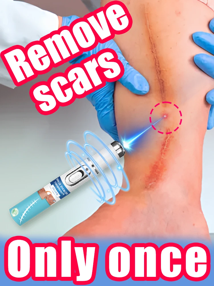 

Laser removes all scars, safe and pain-free