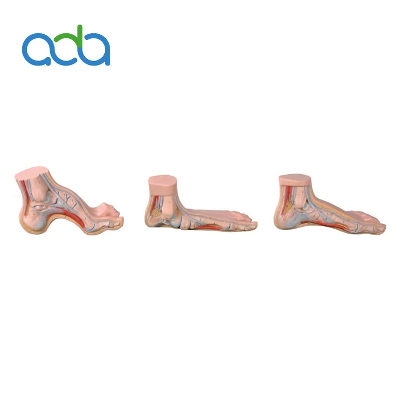 

BIX-A1091 Normal and Flat， Bow Foot Anatomy Model