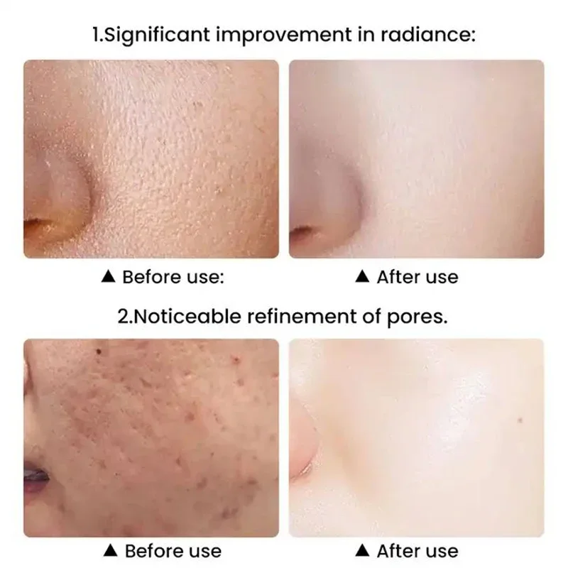 جديد الحليب ضوء LED + IPL العلاج أداة الجمال مع آلة تدليك الوجه بالليزر الرقبة الوجه العلاج بالضوء الأحمر جهاز مكافحة الشيخوخة #6