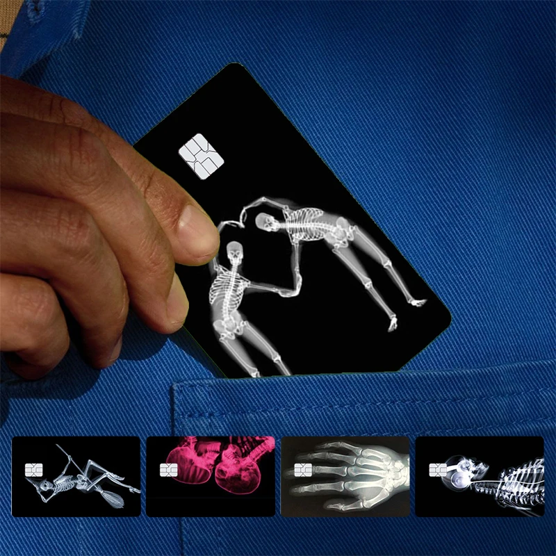 Xray Art Aesthetic …