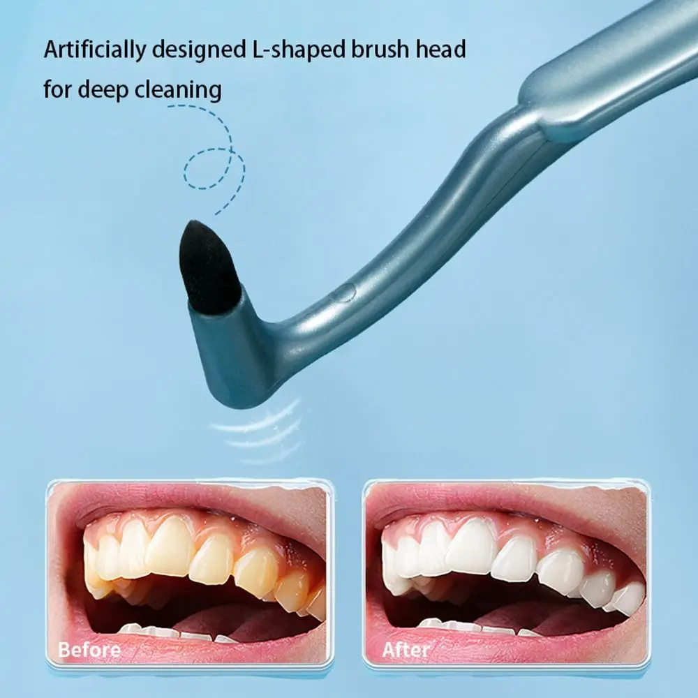 치석 제거 휴대용 칫솔 치과 스케일러, 치과 청소 도구, 초미세 치아 청소 케어