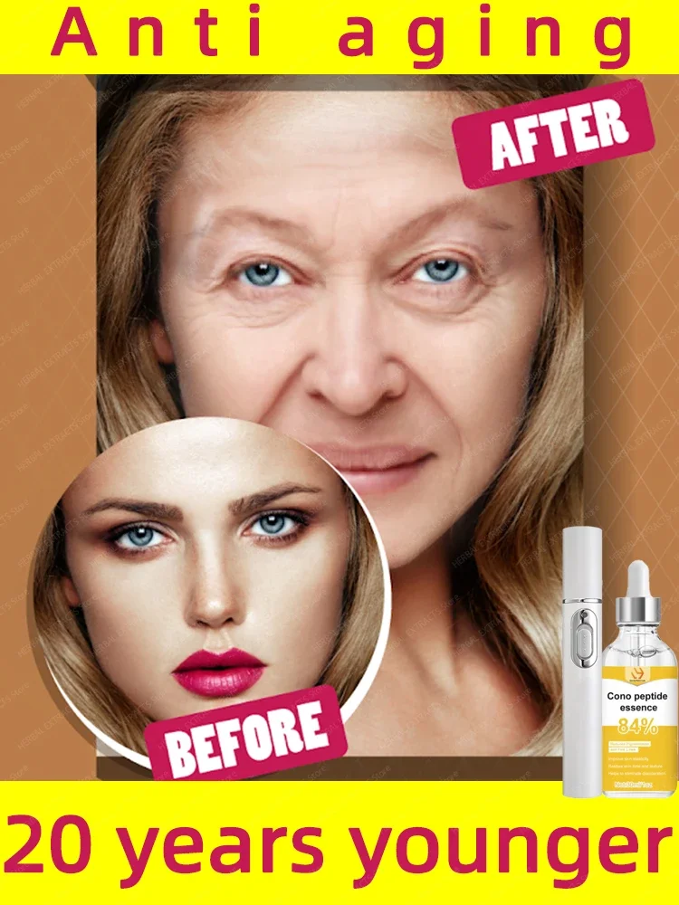 wrinkles disappear become beautiful now