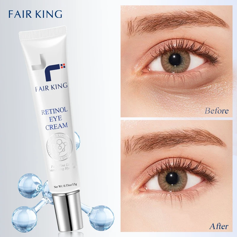 Hydrating and Anti-Aging Eye Treatment Eye Cream to Reduce the Appearance of Dark Circles and Fine Lines Eye Bag Removal Serum