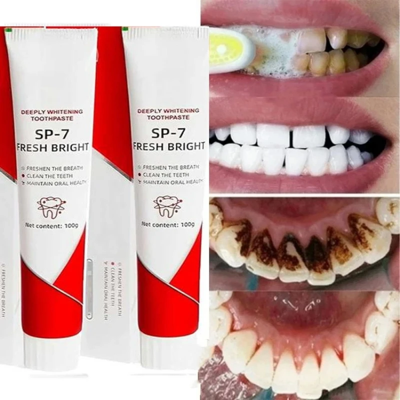 

Sp-7 Probiotic Toothpaste Removing Bad Breath Yellow Teeth Stains Brighten whitening Fresh Breath Oral Health Management Product