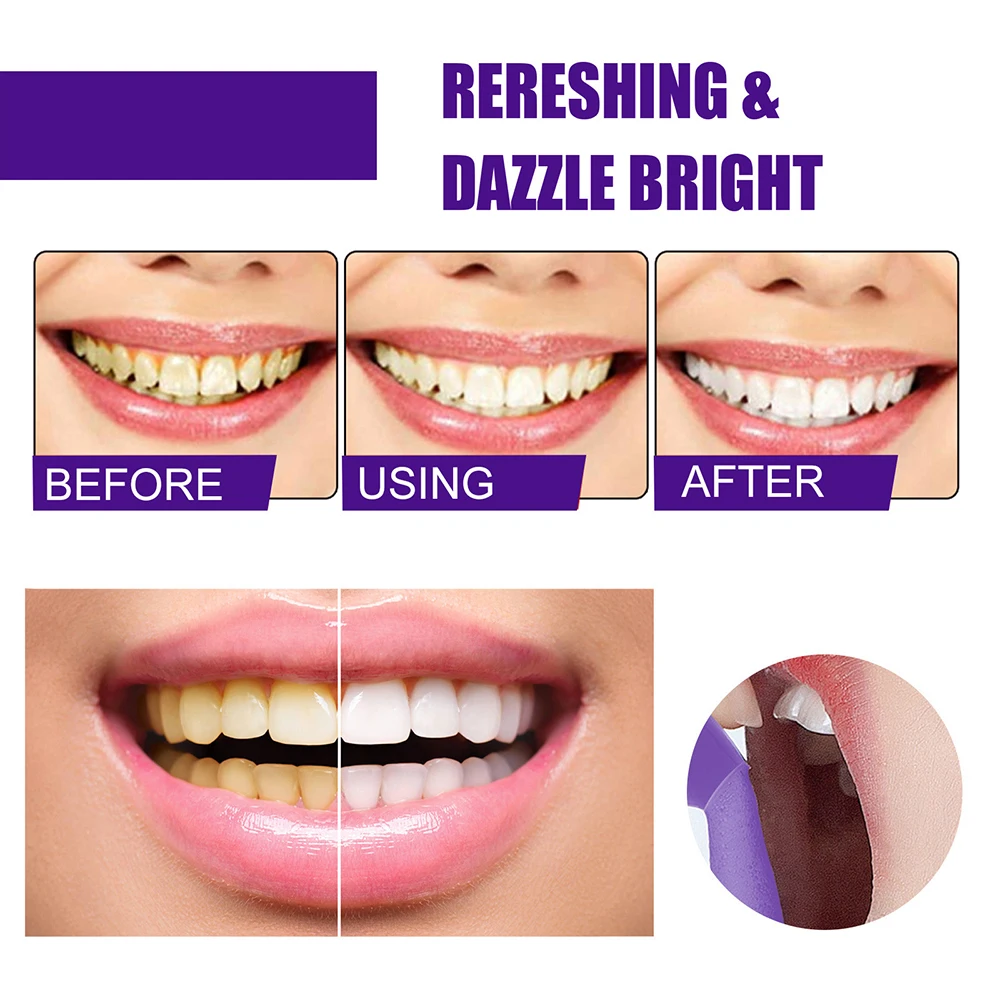 Teeth Whitening Mousse Removes Stains Teeth Whitening Oral Hygiene Toothpaste Whitening Stain Restore Brightness 50ml