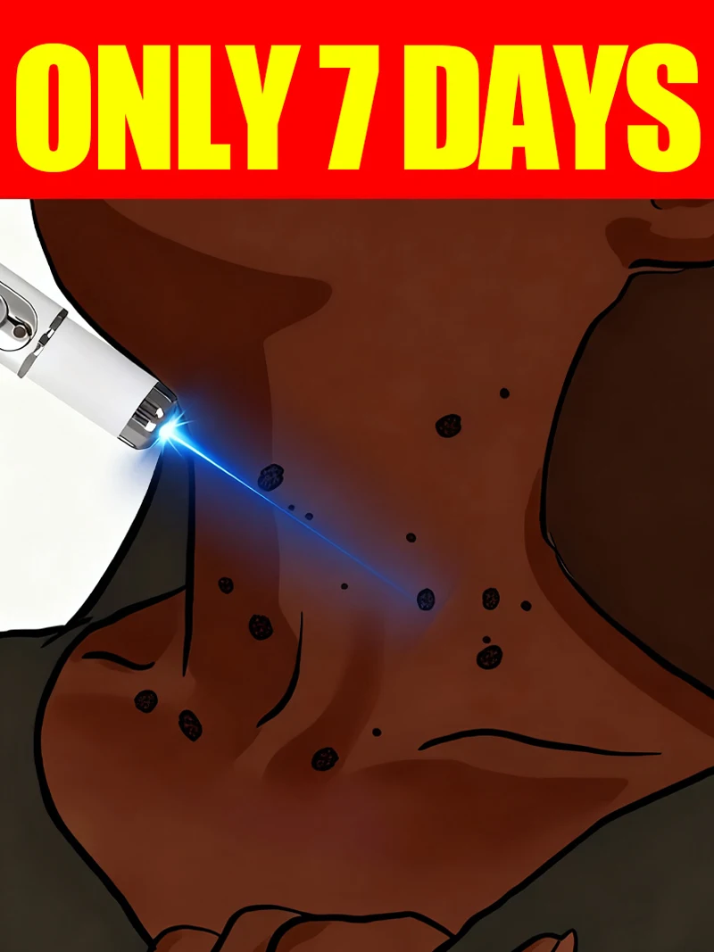 

Wart blue light tool, more discounts on sets