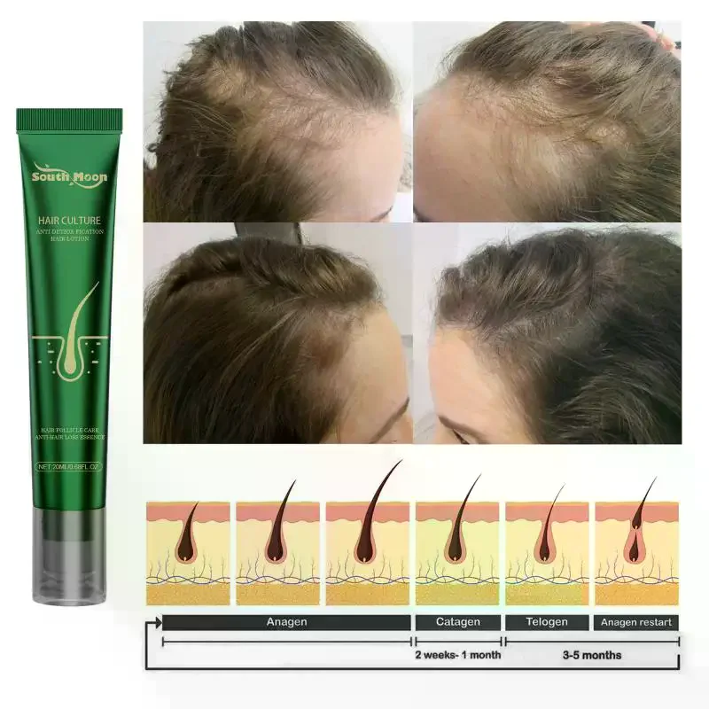 /YOV/Hair Loss Hair Care Deep Nourish Root Improve Loss Reduce Dandruff Soothing Scalp Repair Dry Damaged Scalp Serum Anti-Hair
