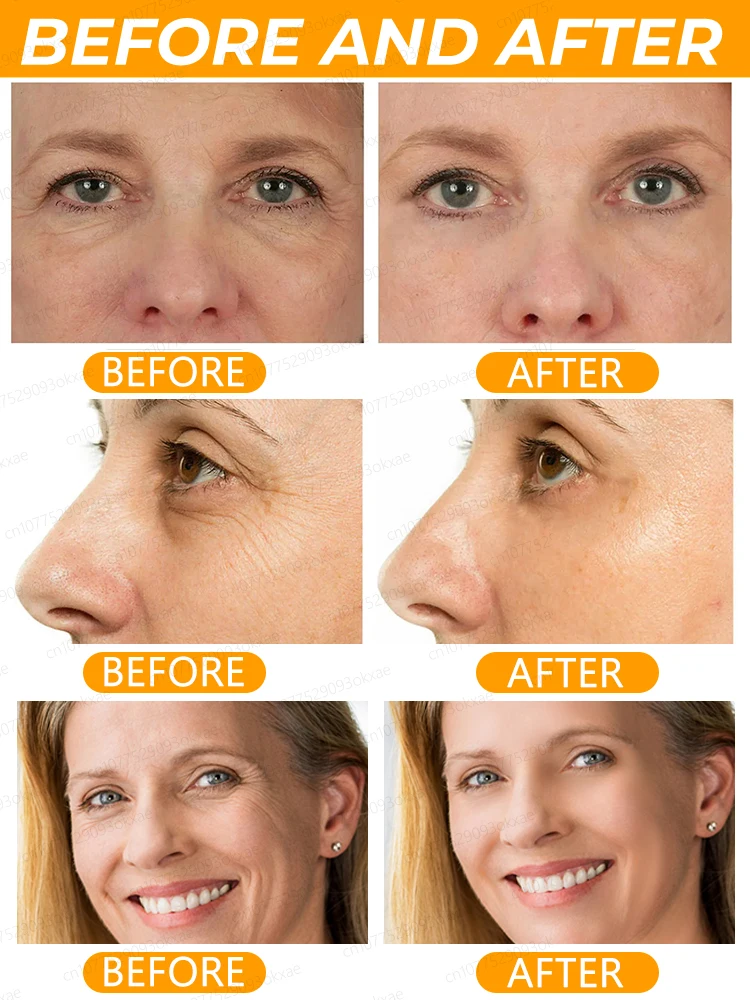 Anti Wrinkle Aging Instant Effect Remove Facial Wrinkles