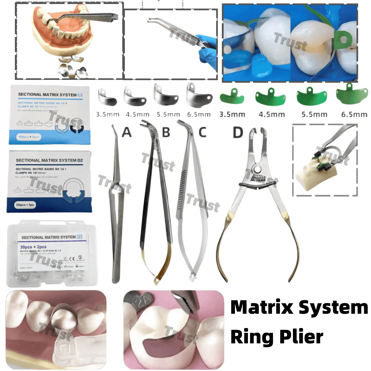 

Dental Matrix Band Sectional Matrices Refill Kit with Wedge Plier & Ti-Ring Matrice Clamp – Essential Dental Tools for Restorati