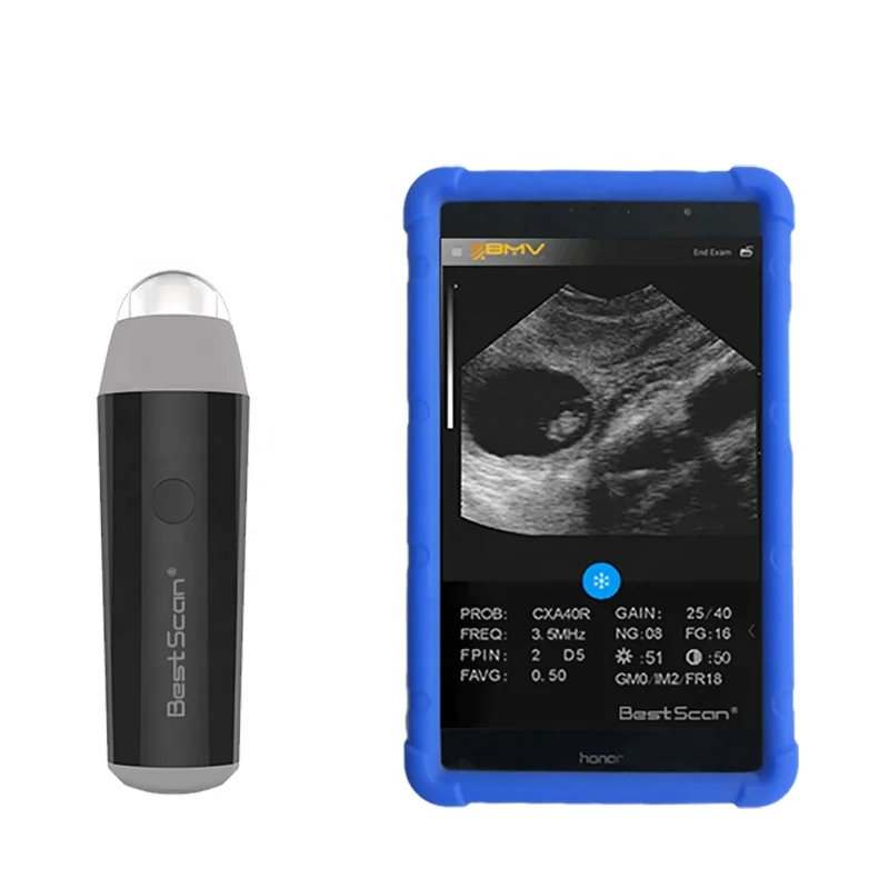 

BestScan S3 wireless goat//Sheep/Pig/sow/porcine portable Veterinary Ultrasound Equipment/Machine/Scanner