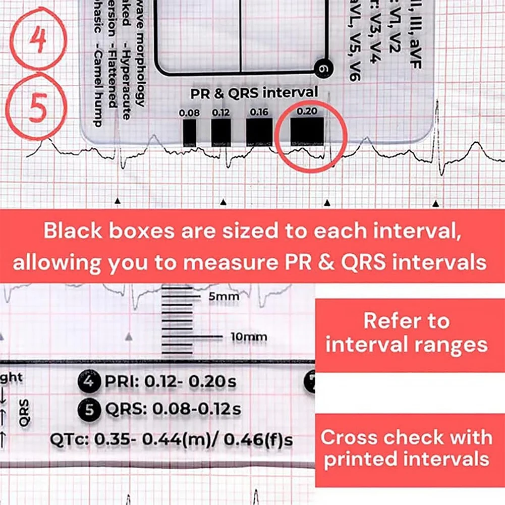 Electrocardiogram 7 Step Ruler Transparent EKG Calipers Measuring Portable Pocket ECG Nurse Easy Carry Ruler EKG Interpretation