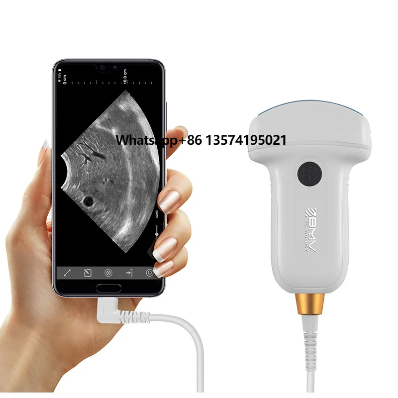 Best Selling Ultrasound Scanner Veterinary Portable for Pig Sheep Goat Testing With Low Price Ultrasound Scanner