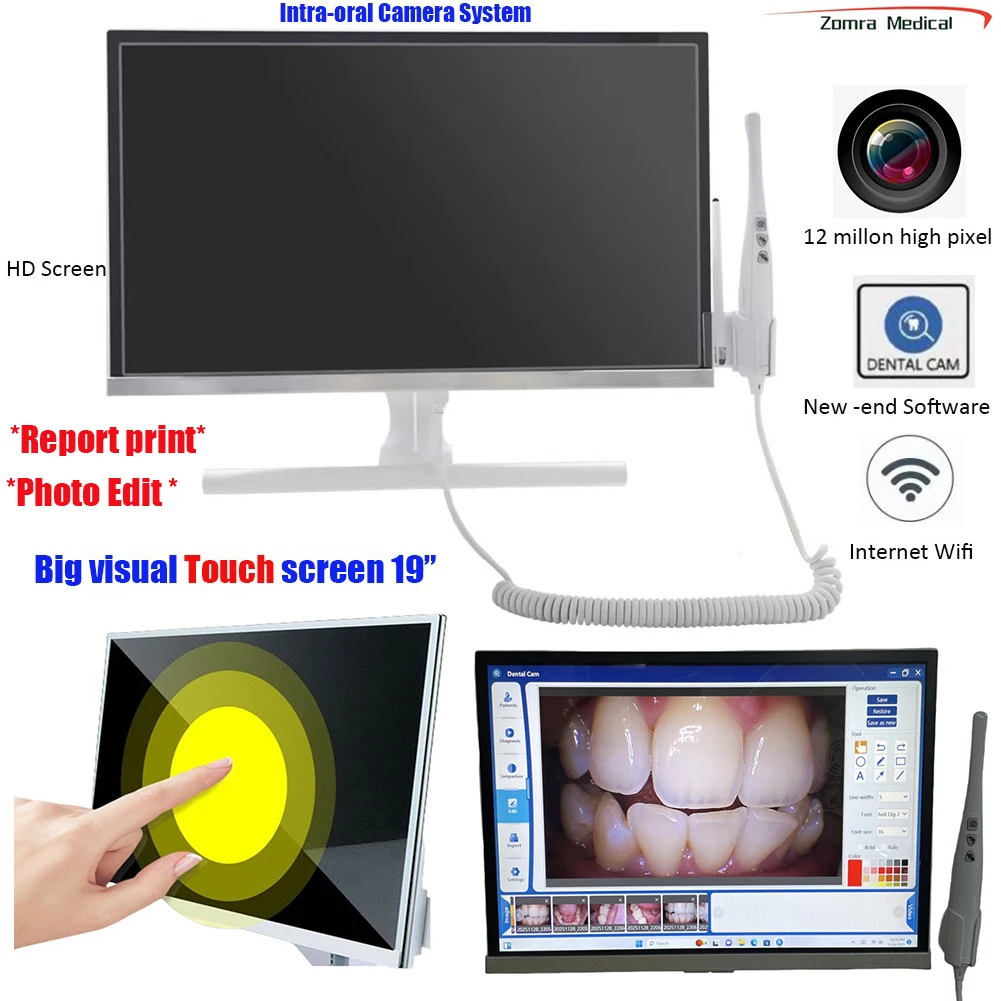 

HD Dental Intra-Oral Camera with 19inch Touch Screen New Software for Oral Examination - Dental Imaging Device