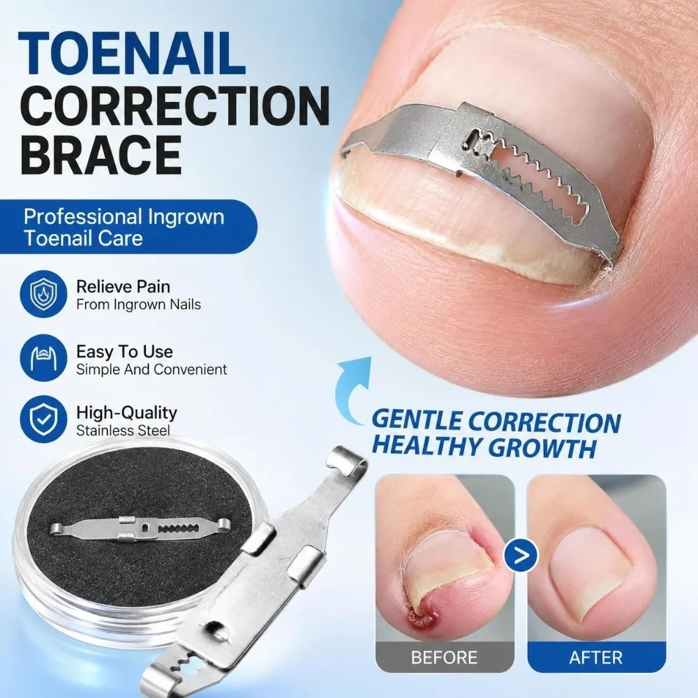 2PCS Adjustable Ingrown Toenail Treatment Curved Design Professional Grade Toenail Straightener Tool Stainless
