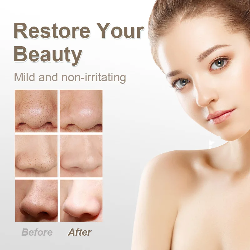 3 وضع الشفط، جهاز تجميل لتنظيف الوجه، مزيل الجلد الميت، مكنسة الوجه، إزالة الرؤوس السوداء