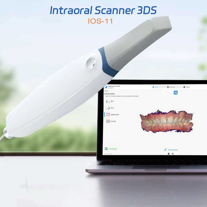 Original Runyes 3DS V3 PRO Digital Dental Intraoral 3D Scanner with Scanning Software Real Color