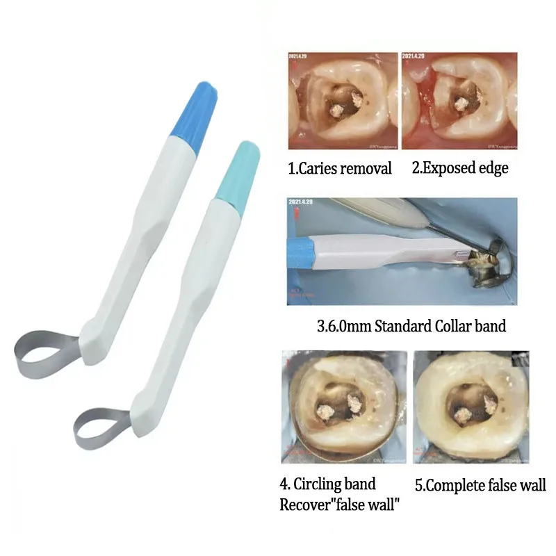 Dental Matrix Band  Adjustable Ring System Stainless Steel Anterior Teeth/General Use Positioning Molding Sheet