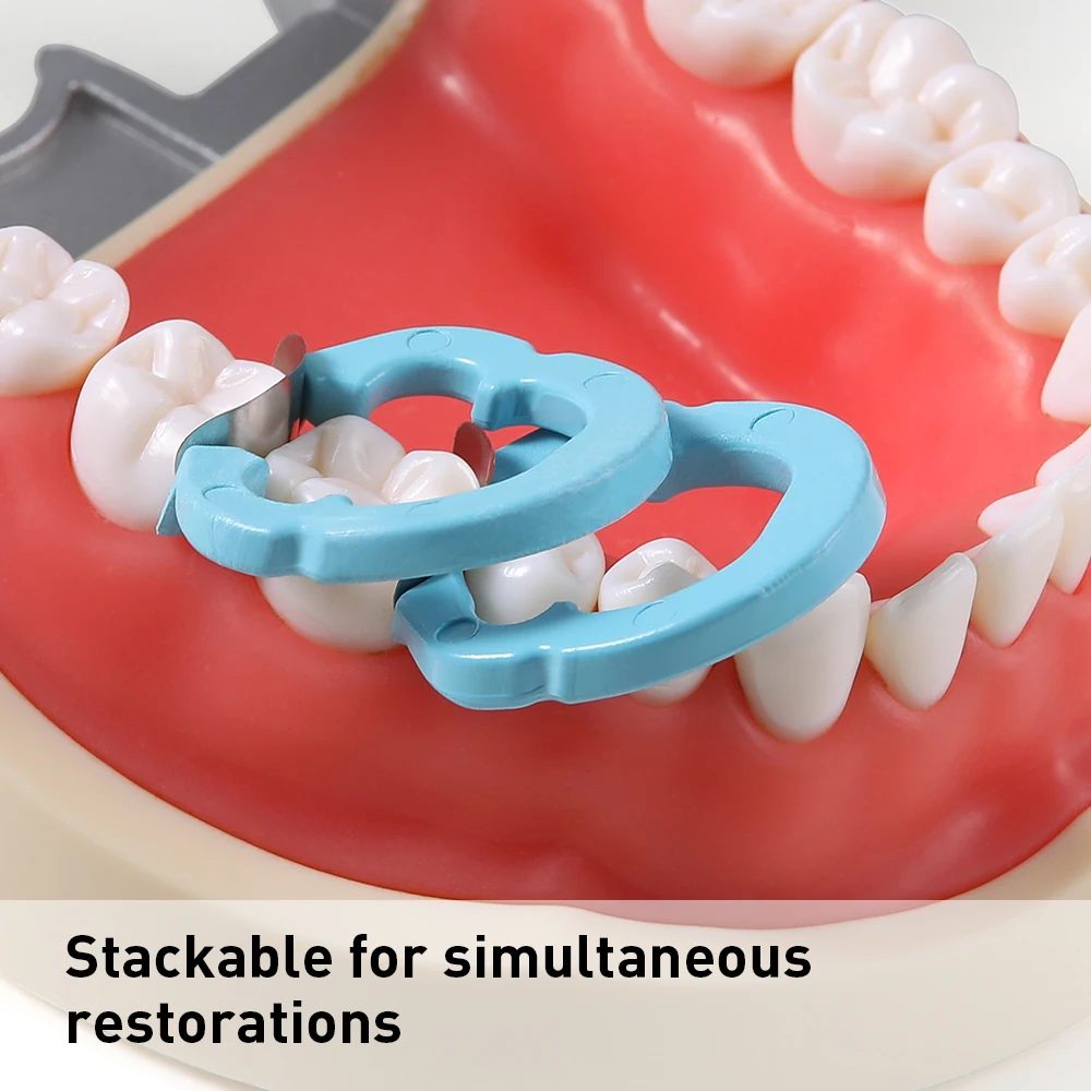 Azdent 4 pçs anel de fixação de resina dentária separador anel seccional contornos metal matriz titular matriz braçadeira fixa autoclavável